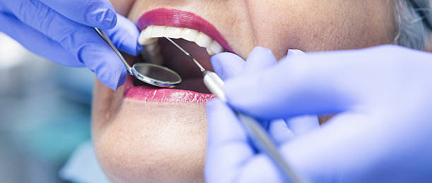 Best Emergency Gum Treatment in Coloma, MI