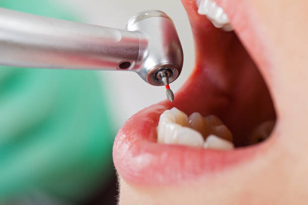 Best Cosmetic Emergency Dentistry in Coloma, MI